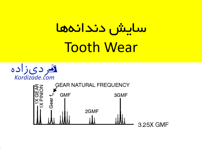 سایش دندانه‌ها